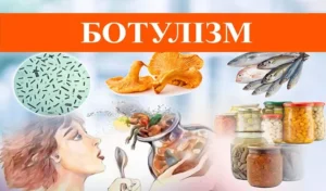 botulizm